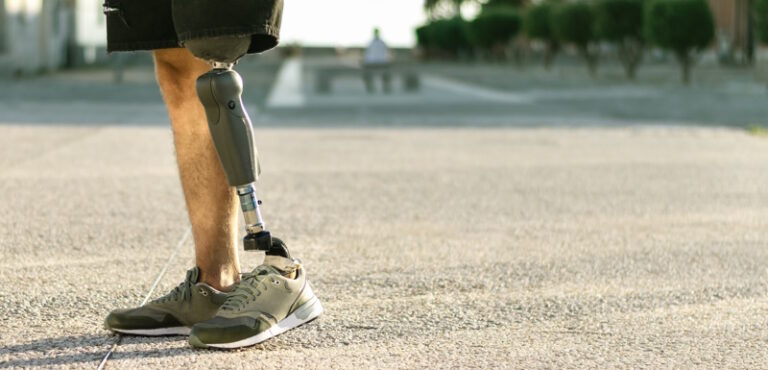 Low angle view at disabled young man with prosthetic leg walking along the street