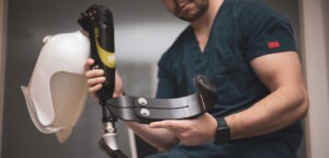 prosthetist fitting custom prosthetic leg