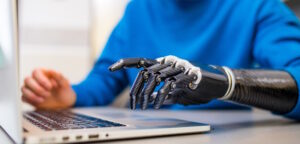 man typing on laptop with robotic prosthetic arm