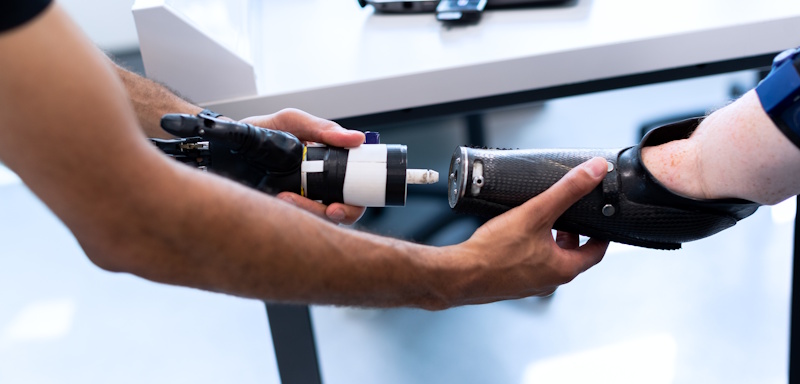 prosthetic device fitting