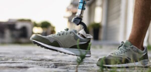 close up on prosthetic leg