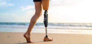 person with a prosthetic leg walking on the beach