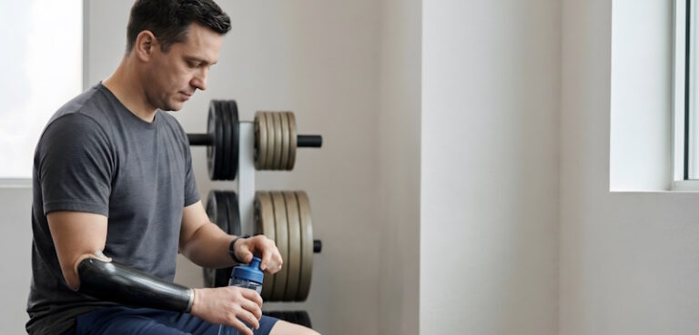 man with a prosthetic arm