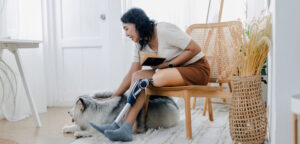 woman with a prosthetic leg