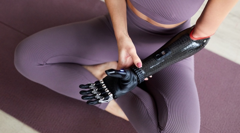 Woman with prosthetic arm exercising