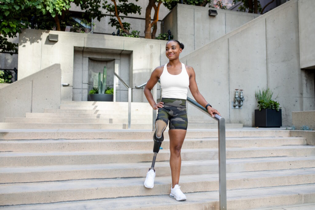 woman with prosthetic leg